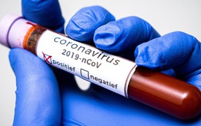Positive result for coronavirus COVID-19